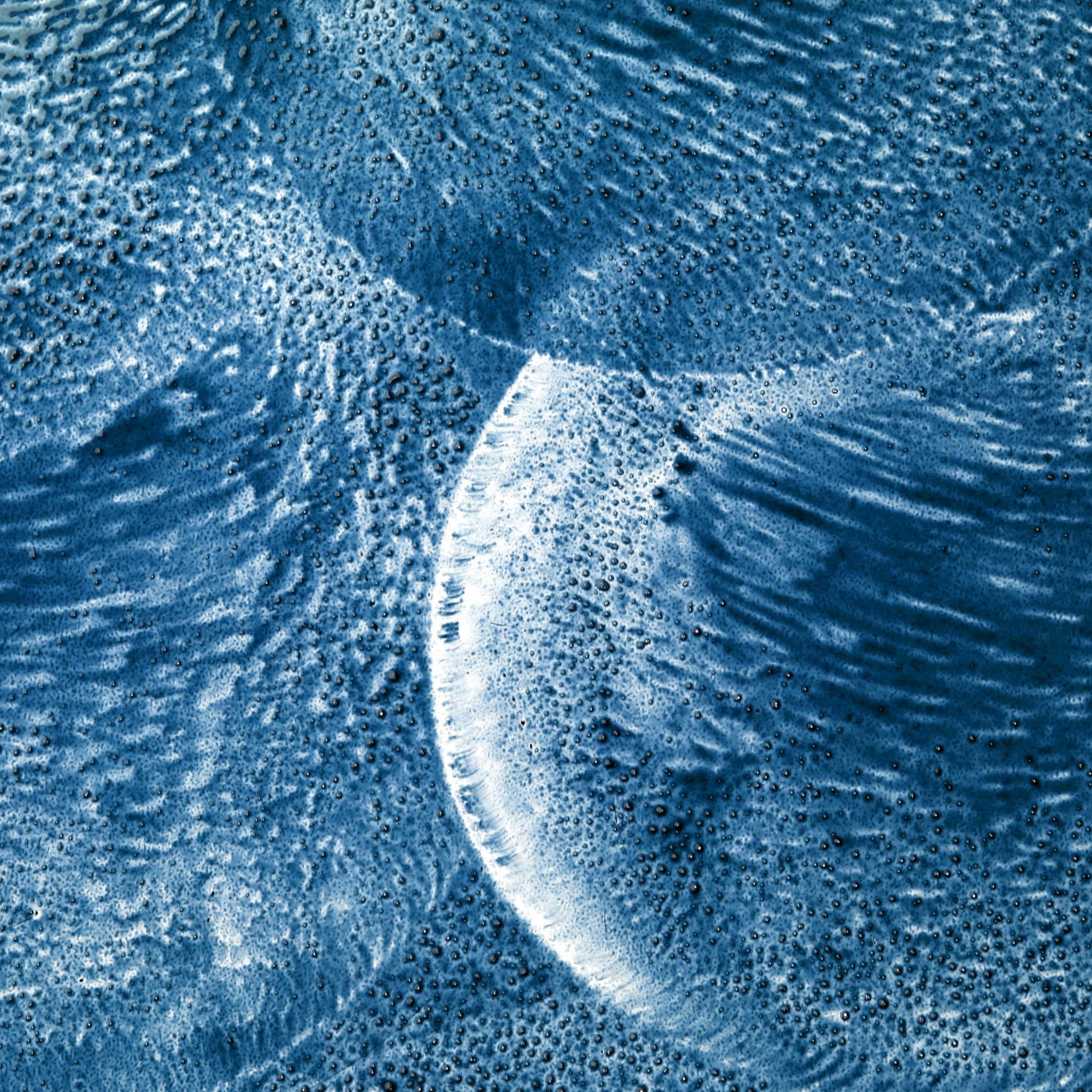 Microbiote intestinal et maladie de Parkinson : une signature révélée